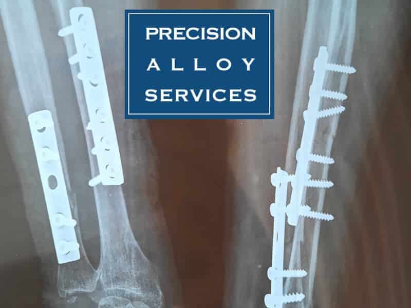 Advancements in Medical Alloys: Custom 465 and Biodur Stainless for Implants